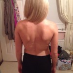 Back Inj