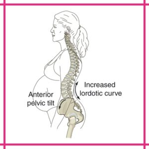 Pregnancy Posture Pic